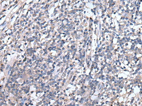 Anti-EMP1 Antibody