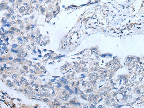 Anti-UBR4 Antibody Anti-UBR4 Antibody