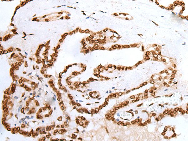 Anti-PIF1 Antibody