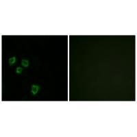 Anti-MUC16 Antibody