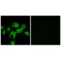 Anti-CDON Antibody