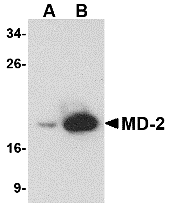 Anti-MD-2 Antibody