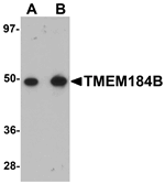 Anti-TMEM184B Antibody