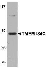 Anti-TMEM184C Antibody