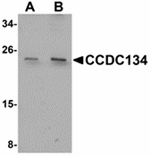 Anti-CCDC134 Antibody