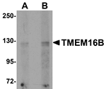 Anti-TMEM16B Antibody Anti-TMEM16B Antibody