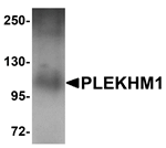 Anti-PLEKHM1 Antibody