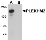 Anti-PLEKHM2 Antibody
