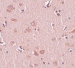 Anti-PLEKHM2 Antibody Anti-PLEKHM2 Antibody