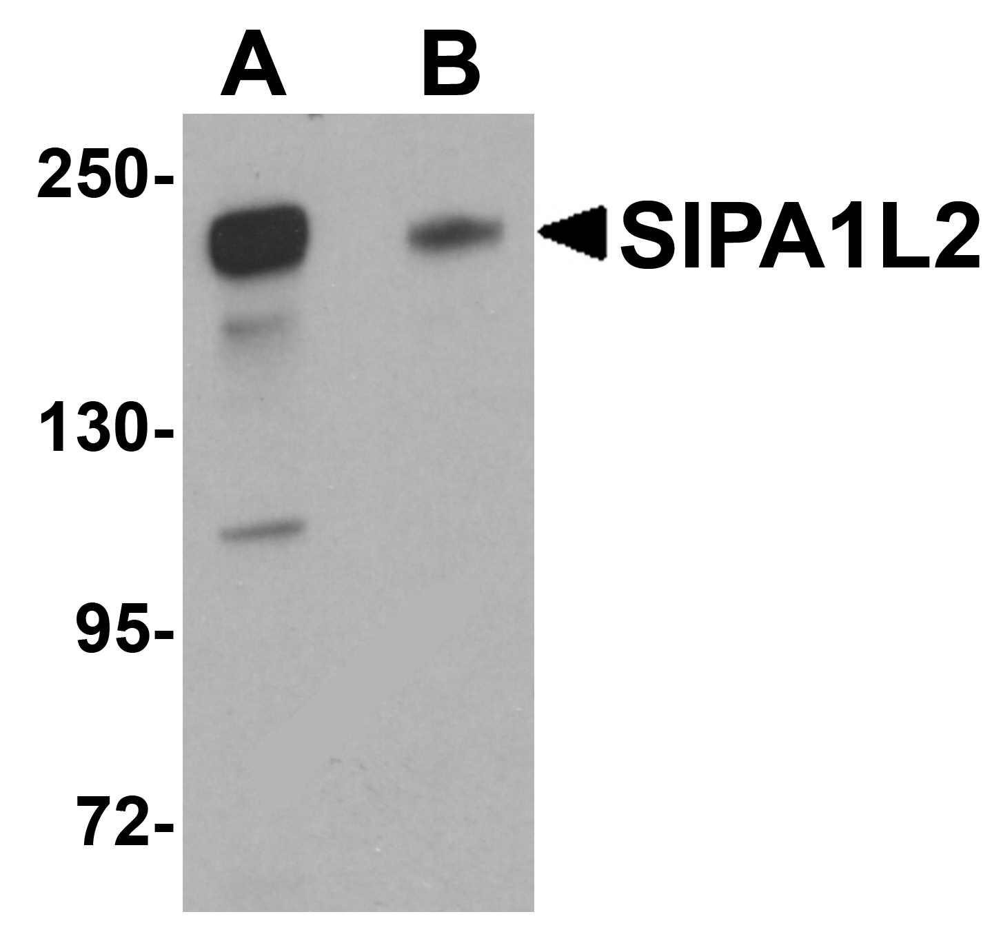 Anti-SIPA1L2 Antibody