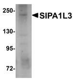 Anti-SIPA1L3 Antibody