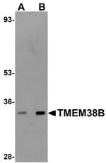 Anti-TMEM38B Antibody