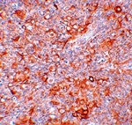 Anti-TMEM38B Antibody Anti-TMEM38B Antibody