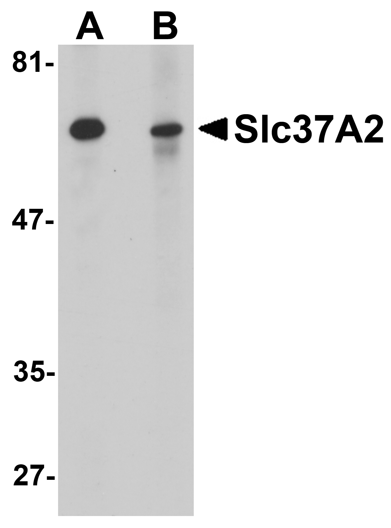 Anti-Slc37A2 Antibody