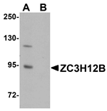 Anti-ZC3H12B Antibody
