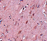 Anti-ZC3H12B Antibody Anti-ZC3H12B Antibody