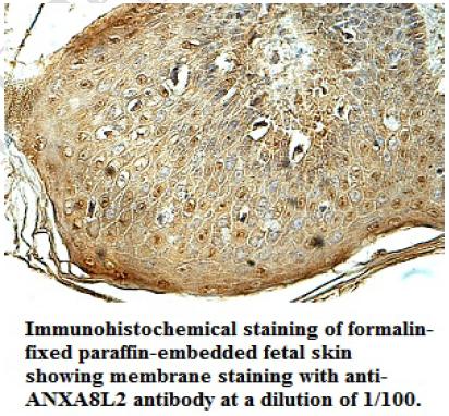 Anti-ANXA8L2 Antibody