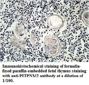 Anti-PITPNM2 Antibody