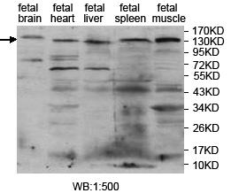 Anti-PITPNM2 Antibody Anti-PITPNM2 Antibody