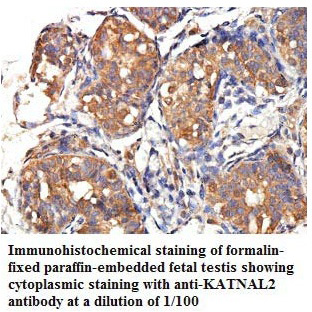 Anti-KATNAL2 Antibody
