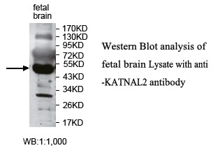 Anti-KATNAL2 Antibody Anti-KATNAL2 Antibody