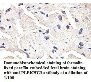 Anti-PLEKHG3 Antibody