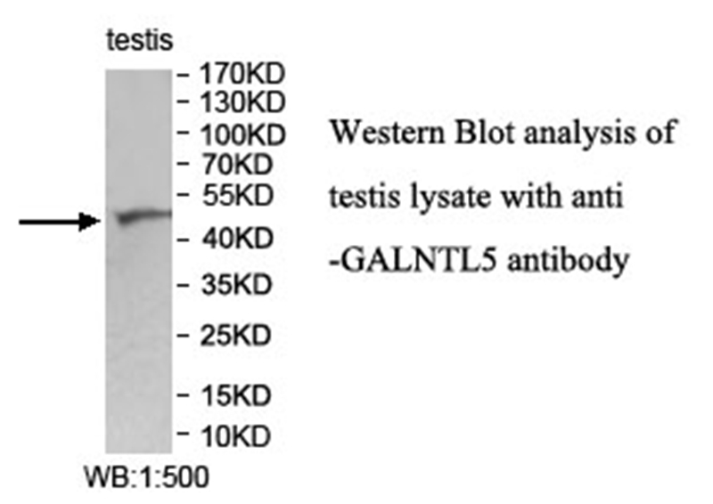 Anti-GALNTL5 Antibody