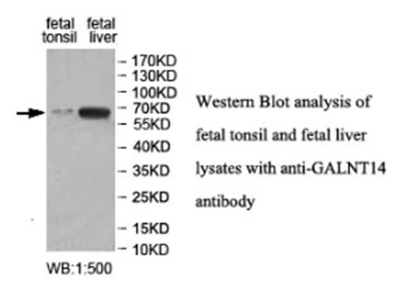 Anti-GALNT14 Antibody