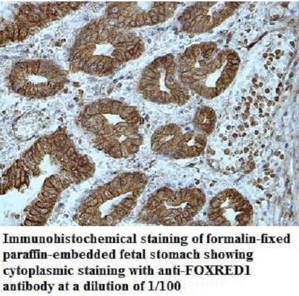 Anti-FOXRED1 Antibody