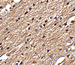 Anti-Spred3 Antibody Anti-Spred3 Antibody