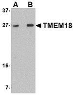 Anti-TMEM18 Antibody