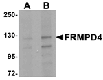 Anti-FRMPD4 Antibody
