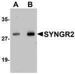 Anti-SYNGR2 Antibody
