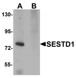 Anti-SESTD1 Antibody