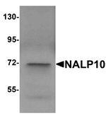 Anti-NALP10 Antibody