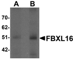 Anti-FBXL16 Antibody