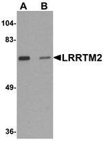 Anti-LRRTM2 Antibody