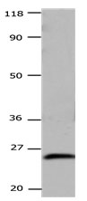 Anti-CSNK2B Antibody