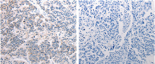 Anti-CSNK2B Antibody Anti-CSNK2B Antibody