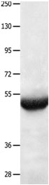 Anti-BPIFB3 Antibody