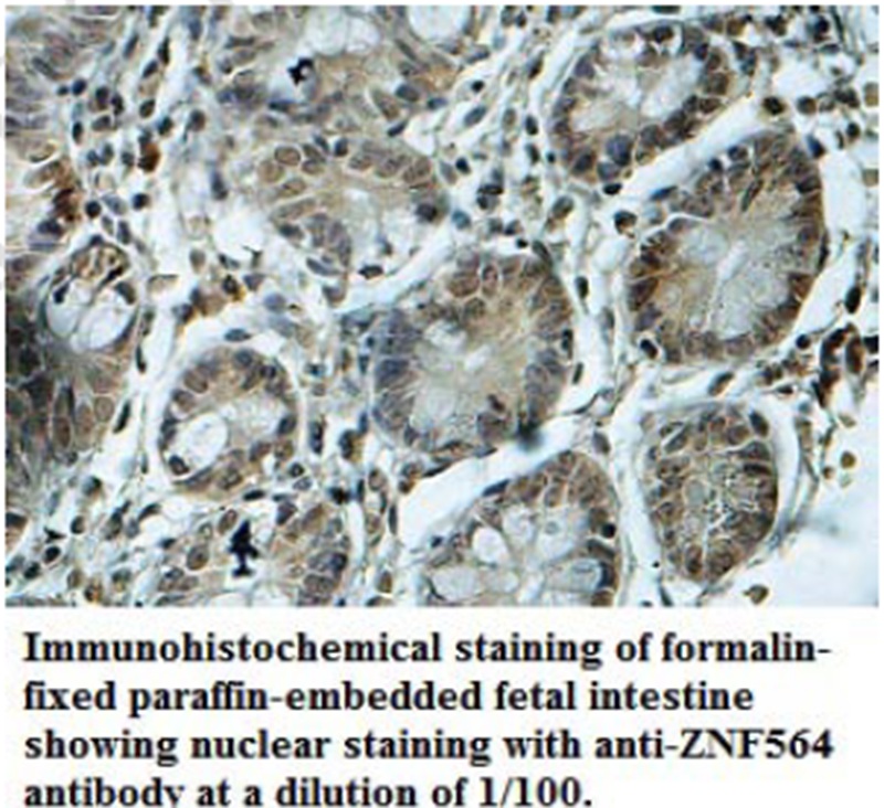 Anti-ZNF564 Antibody