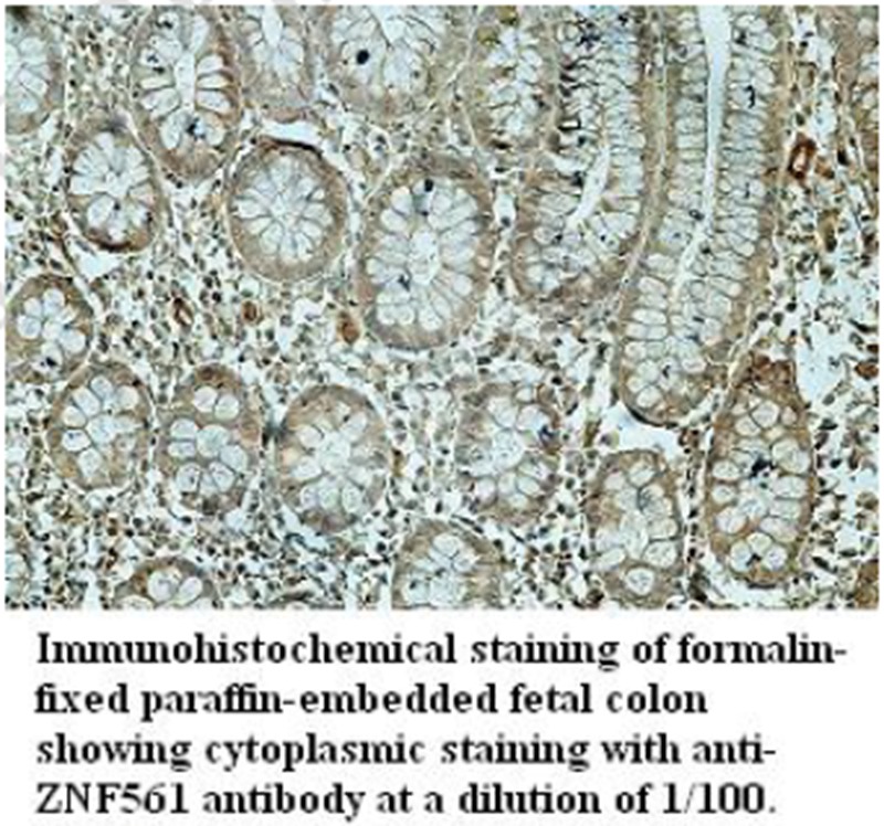 Anti-ZNF561 Antibody