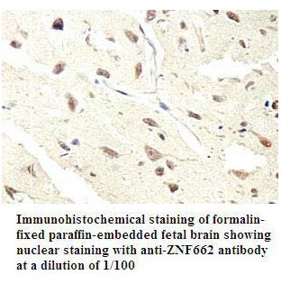 Anti-ZNF662 Antibody