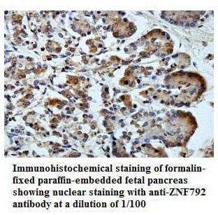 Anti-ZNF792 Antibody