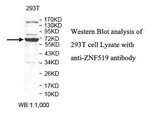 Anti-ZNF519 Antibody Anti-ZNF519 Antibody
