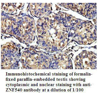 Anti-ZNF540 Antibody