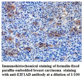 Anti-EIF1AD Antibody