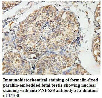 Anti-ZNF658 Antibody