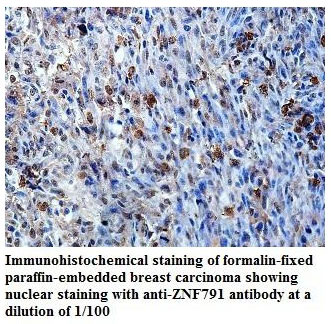 Anti-ZNF791 Antibody