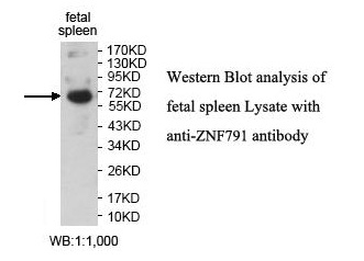 Anti-ZNF791 Antibody Anti-ZNF791 Antibody